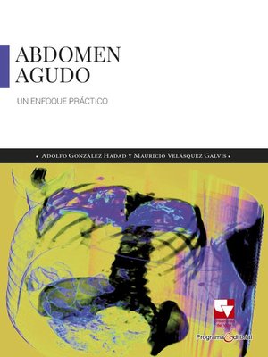cover image of Abdomen agudo